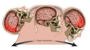 Brain