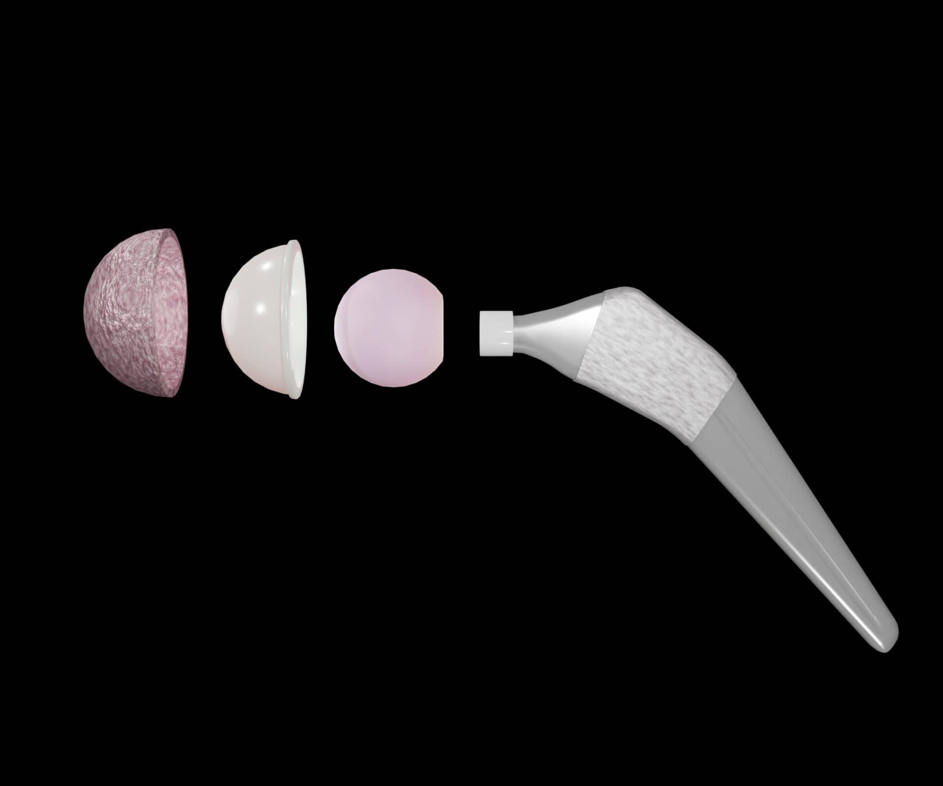 Total hip replacement components and examples of commercial hip stem implant 3D Rendering